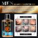 Beard Growth Oil for Men | Premium Beard Serum & Care Kit for a Fuller Beard - Buy Online on GoSupps.com