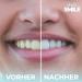 Viva La Smile Coconut Activated Carbon Powder for Teeth Whitening - Natural Charcoal Toothpaste (Mint) - Brighten Your Smile - Buy Online on GoSupps.com