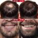 Strong Roots Men Stubble & Bump Control | Natural Aftershave for Razor Bumps Ingrown Hair & Smooth Skin - Jamaican Black Castor Oil & Red Pimento - Buy Online on GoSupps.com