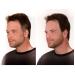 Dark Blonde Beard & Mustache Darkener - Non Allergenic Formula | 1 Minute Application - Buy Online on GoSupps.com