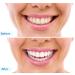 Organic Coconut Charcoal Teeth Whitening Powder - 100% Natural Beauty Care - Buy Online on GoSupps.com