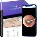EARGEAR - Wireless Visual Ear Camera Otoscope Ear Wax Removal Kit with Extractor Camera & LED Lights - Smart & Safe Earwax Cleaner - Connects to iOS & Android (Cosmic Blue).