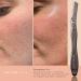 Brandluxe Dermaplaning Tool - Gentle Face & Eyebrow Hair Removal Eco-Friendly Design Includes 3 Swedish Carbon Blades - Buy Online on GoSupps.com