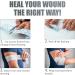 Healqu Non-Woven Dressing Retention Tape 2in x 11yd - Pack of 2 | Adhesive Cloth Tape for Wound Care - Buy Online on GoSupps.com