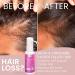 Remixidil Minoxidil 2% Hair Growth Spray for Women - Thinning Hair Regrowth & Thickening Treatment | Fast International Shipping - Buy Online on GoSupps.com