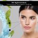 RAU Retinol Serum 3.38 FL oz - Vitamin A Concentrate with Ceramide Panthenol & Hyaluronic Acid | Anti-Wrinkle & Blemish Treatment for Mature & Impure Skin - International Shipping Available - Buy Online on GoSupps.com