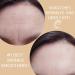 Skin Supervision Facial Tape for Wrinkles - Anti Wrinkle Patches for Face - Wrinkle Tape for Face - Forehead Wrinkle Remover - Face Smoothing Patch - Wrinkles Treatment - Buy Online on GoSupps.com