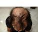 Dark Chocolate Brown Finally Hair Fiber Refill - 456g for Hair Loss Concealment | Finally Hair - Buy Online on GoSupps.com
