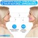 Customizable Soft Denture Mouthguard for Grinding Relief - Upper & Lower Set | Ideal for Denture Wearers & Implant Patients - Buy Online on GoSupps.com