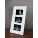 SignatureFrames Baby Scan Photo Frame. Triple ultrasound scan frame in gloss white.