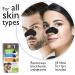 Global Beauty Care Premium Variety Pack Nose Cleansing Strips - Charcoal, Tea Tree, Witch Hazel & Vitamin C (18 Ct) | Blackheads Removal Strips - Buy Online on GoSupps.com