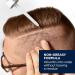 Head & Shoulders Scalp X Minoxidil for Men - Pack of 3 - 2 Fl Oz. - Buy Online on GoSupps.com