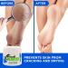 Buy Dry Skin Lanolin Cream - Heal Cracked Heels Elbows & Soft Hands | Crack Blaster Revive - Fast International Shipping - Buy Online on GoSupps.com