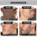 Anthony Brown Oil Beard Growth Kit | Money Back Guarantee | Tabed Effect for Enhanced Beard Growth | Bart Warser Men s Roller 0.5mm - Buy Online on GoSupps.com