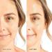 Tree of Life Hyaluronic Acid Serum for Face - Anti Aging, Fine Lines, Dark Spots, Dry Skin - 2 Fl Oz - Buy Online on GoSupps.com