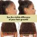 Organic Rice Water Hair Growth DIY Kit with Spray Bottle - Deep Conditioner for Damaged, Dry, Frizzy, Curly Hair - Buy Online on GoSupps.com