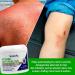 TriDerma Intense Fast Healing Cream - Sores Cuts Scrapes Rashes & Cracked Skin | Therapeutic Skin Care Pack of 4 - Fast International Shipping - Buy Online on GoSupps.com