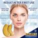 Stylia 30PC 24K Gold Under Eye Masks + 7 Chin Masks - Revitalize and Lift for Radiant Skin - Buy Online on GoSupps.com