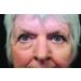 Rox Flawless Eyes by RX | Premium Eye Care for Radiant Skin | Shop Internationally Now - Buy Online on GoSupps.com