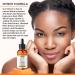 Vitamin C Hyaluronic Acid Serum for Face | Anti Aging, Dark Spot, Wrinkle, Acne Scar Treatment - Buy Online on GoSupps.com