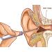 REMOS Stainless Steel Ear Loop & Spoon - Effective Ear Wax Removal Tool (White) | International Shipping Available - Buy Online on GoSupps.com