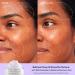 Alpyn Wild Huckleberry Recovery Peel - Exfoliate Moisturize & Soothe Skin | Reduce Redness | 1.7 oz / 50 ml - International Shipping Available - Buy Online on GoSupps.com