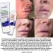 TriDerma Scar Block Clear Gel - Soothing Treatment for Scars - Buy Online on GoSupps.com