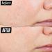 Kiehl's Expertly Clear Moisturizer with 1.2% Salicylic Acid & 2% Niacinamide Hydrating Acne Treatment Fades Post-acne Marks Corrects Uneven Texture & Tone Prevents Future Breakouts - 2 fl oz - Buy Online on GoSupps.com