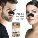 Global Beauty Care 18 Premium Nose Cleansing Strips | Activated Charcoal & Vitamin C Blackhead Remover - International Shipping - Buy Online on GoSupps.com