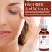 Rosehip Oil Facial Serum - Anti-Oxidant Rich Pore Minimizer | Skin Moisturizing Face Oil for All Skin Types - 1.0 Fl Oz/30ml - Buy Online on GoSupps.com