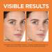 L'Oreal Paris Revitalift Vitamin C Serum with Vitamin E & Salicylic Acid - Moisturizing, Smoothing & Brightening Formula - Non-Greasy - Sample Size - Buy Online on GoSupps.com