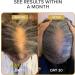 Shedavi Iconic Natural Hair Vitamins for Fast Hair Growth - Pure Hair Supplements Formulated with Vitamins to Promote Thicker Stronger Hair - Vegan Hair Care for Hair Loss - Non-GMO (60 Capsules) - Buy Online on GoSupps.com