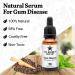 Organic Neem & Clove Gum Disease Remedy - Natural Gingivitis Treatment 1 Fl Oz - Buy Online on GoSupps.com