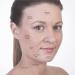 Sandine Pink Cupping Therapy Set for Facial Contouring and Cellulite Reduction - Buy Online on GoSupps.com