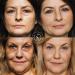 AGELXR Instant Wrinkle Remover Serum | Tightens Wrinkles & Fine Lines | Diminishes Puffy Eyes | Anti-Aging Formula with Argireline | 10 Vials - Buy Online on GoSupps.com