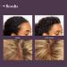 Inala Power Potion | Rice Water Complex Serum for Scalp Health & Hair Growth | Minimizes Breakage, Strengthens Hair | All Hair Types | 1.5oz - Buy Online on GoSupps.com