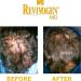 REVIVOGEN MD Scalp Therapy | Natural Hair Loss Solution for Fine & Thinning Hair - International Shipping - Buy Online on GoSupps.com