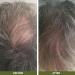Tea Tree Oil Hair Loss Conditioner 200ml - Smooth & Shine Formula with Lemon Myrtle - Protects Against Breakage - Australian Capilia Longa & Shea Butter - Natural Ingredients - Pack of 1 - Buy Online on GoSupps.com