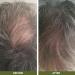 Hair Loss Shampoo 200ml with Lemon | Promotes Hair Growth for Thin & Fine Hair | Ideal Solution for Hair Loss - Buy Online on GoSupps.com