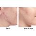 Shop CLINIQUE Acne Solutions Clarifying Lotion - 6.7 oz/ 200 mL Online - Best Price & International Shipping - Buy Online on GoSupps.com