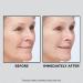 Shop Peter Thomas Roth Instant FIRMx Temporary Face Tightener - 3.4 oz Online - Best Price & International Shipping - Buy Online on GoSupps.com