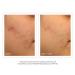 Shop Murad Acne Control Clarifying Cleanser - 6.75 oz Online - Best Price & International Shipping - Buy Online on GoSupps.com