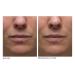 Shop Dr. Dennis Gross Skincare Hyaluronic Marine Hydrating Modeling Mask - 4 treatments Online - Best Price & International Shipping - Buy Online on GoSupps.com