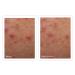 Shop Murad Rapid Relief Acne Spot Treatment - 0.5 oz/ 15 mL Online - Best Price & International Shipping - Buy Online on GoSupps.com