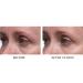 Shop Dr. Dennis Gross Skincare Hyaluronic Marine Dew It Right Eye Gel - 0.5 oz/ 15 mL Online - Best Price & International Shipping - Buy Online on GoSupps.com