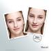 Shop Murad Outsmart Acne Clarifying Treatment - 1.7 oz/ 50 mL Online - Best Price & International Shipping - Buy Online on GoSupps.com