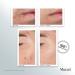 Shop Murad Outsmart Acne Clarifying Treatment - 1.7 oz/ 50 mL Online - Best Price & International Shipping - Buy Online on GoSupps.com