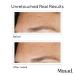 Shop Murad Replenishing Multi-Acid Peel - 3.3 oz/ 100 mL Online - Best Price & International Shipping - Buy Online on GoSupps.com
