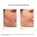 Shop Murad Oil and Pore Control Mattifying Face Sunscreen SPF 45 PA++++ - 1.7 oz/ 50 mL Online - Best Price & International Shipping - Buy Online on GoSupps.com