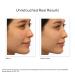 Shop Murad Oil and Pore Control Mattifying Face Sunscreen SPF 45 PA++++ - 1.7 oz/ 50 mL Online - Best Price & International Shipping - Buy Online on GoSupps.com